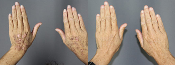 Age & Sun Spot Treatment #5328 Image